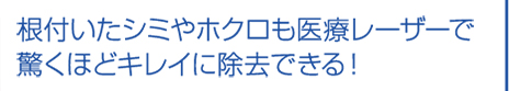 根付いたシミやホクロも医療レーザーで驚くほどキレイに除去できる！
