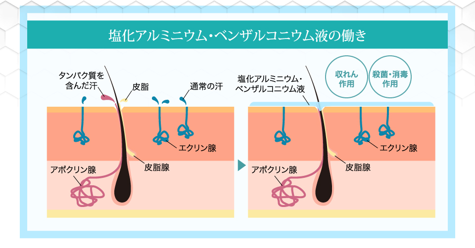 塩化アルミニウム・ベンザルコニウム液の働き